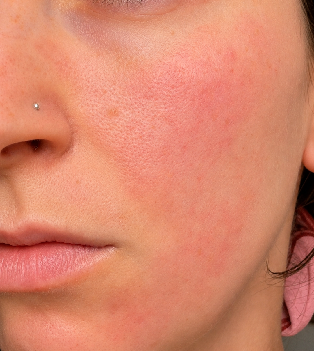How to choose anti-ageing cream for sensitive skin