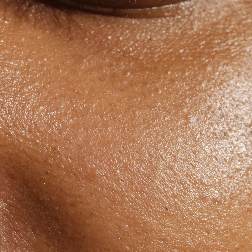 How to choose the best vegan skincare products for your skin type