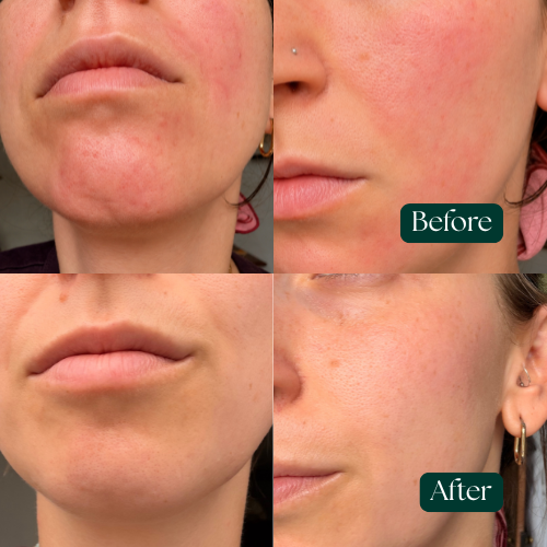 Pure Organic Anti-Ageing Cream for Sensitive Skin