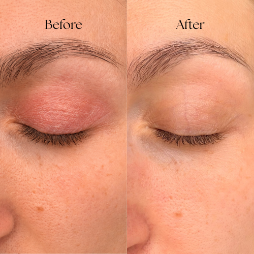 Pure Organic Anti-Ageing Cream for Sensitive Skin