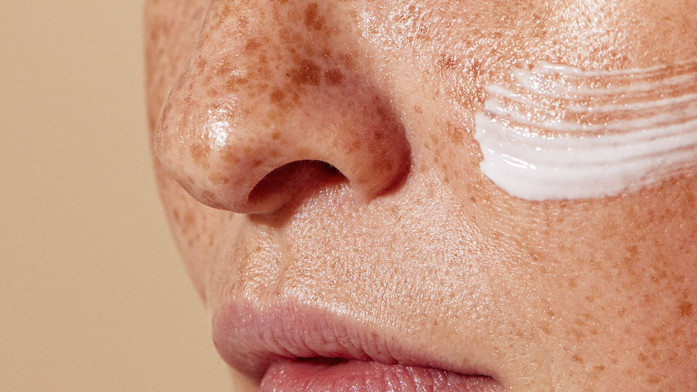 close up of woman with freckles cream on her face