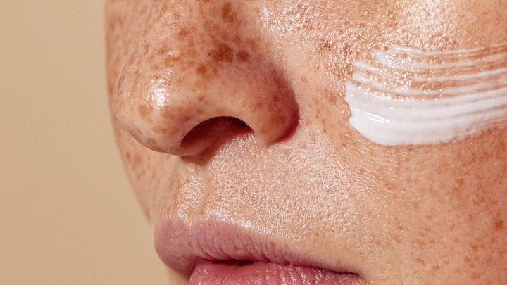 close up of woman with freckles cream on her face